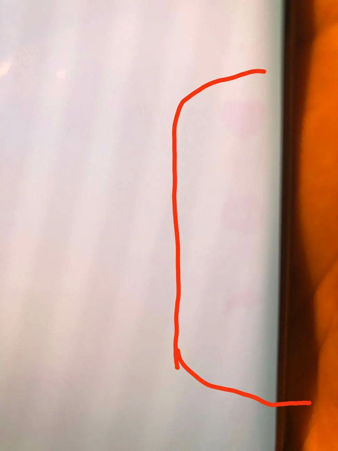 手机烧屏会不会自己恢复正常  第1张
